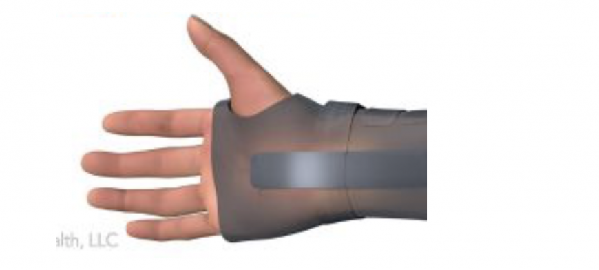 Nocturnal splints for carpal tunnel syndrome in Dubai Nocturnal splints for carpal tunnel syndrome in Dubai